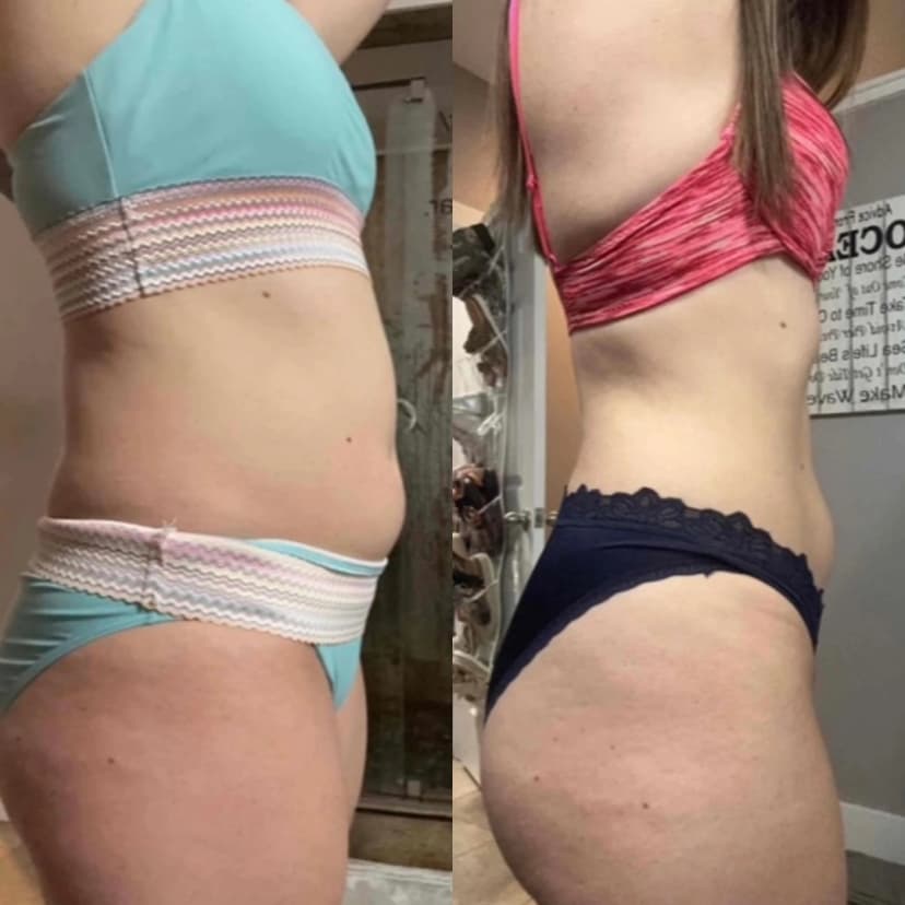 Weight Loss Journey